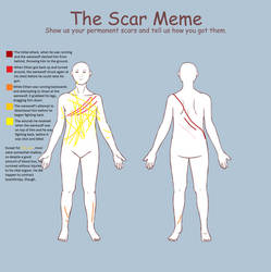 Ethan's Scar Chart