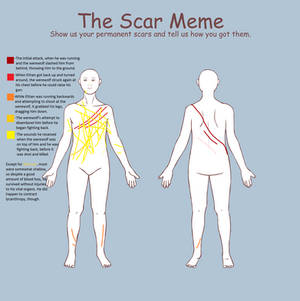 Ethan's Scar Chart