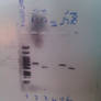 Gel electrophoresis