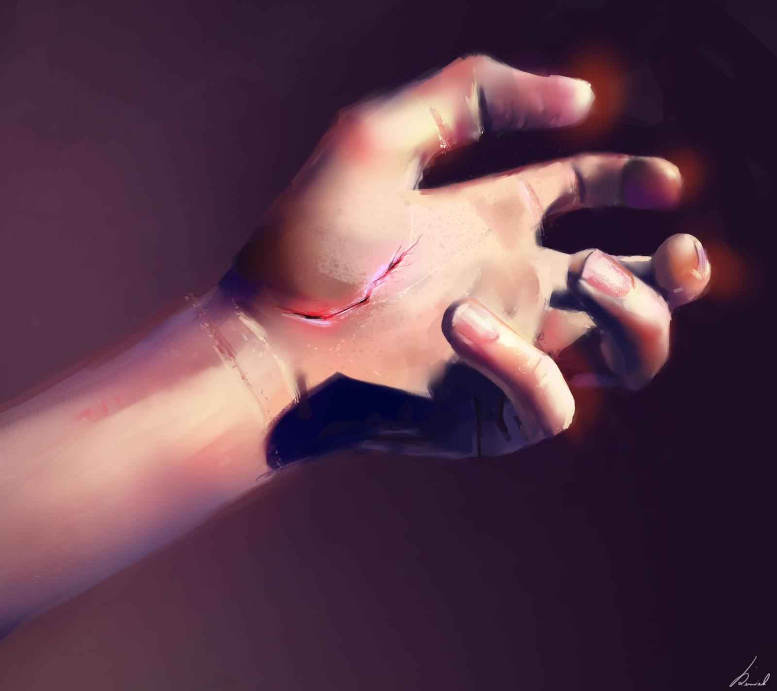 Scarred hand