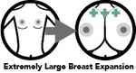 Extremely Large Breast Expansion green by unnamed47