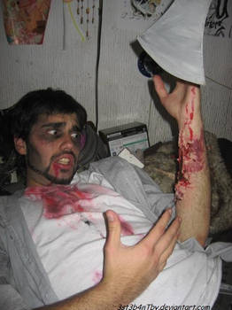 Rayos! Me mordieron!