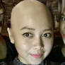 Bald Lady