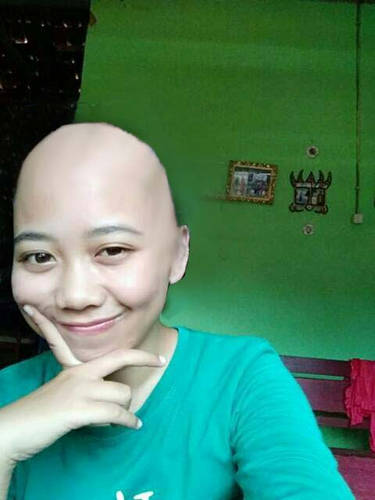 Bald Girl from Indonesian