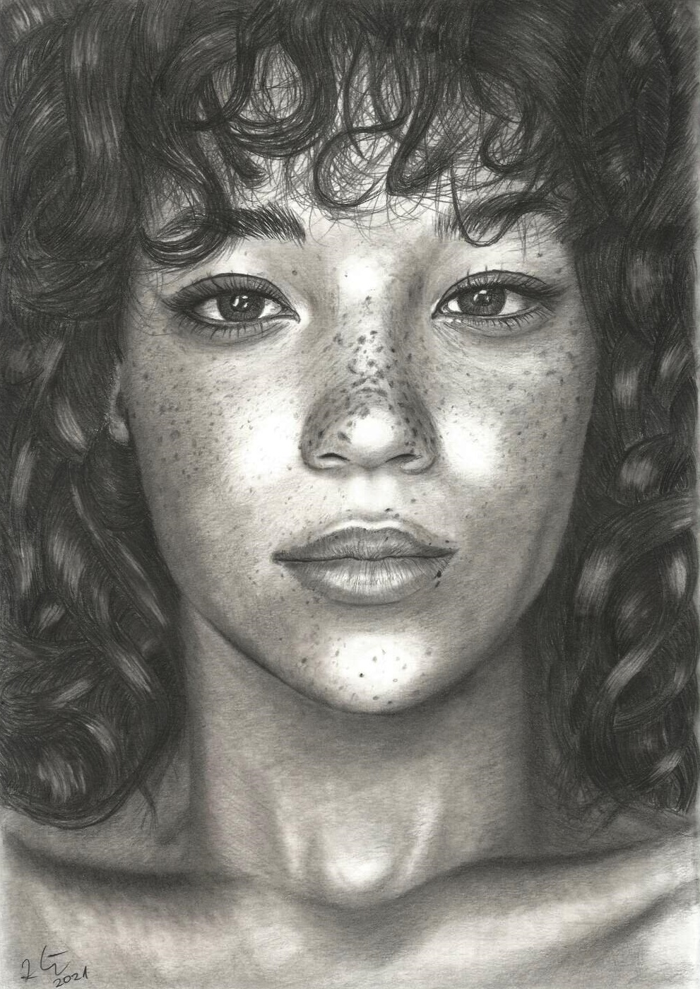 Freckles