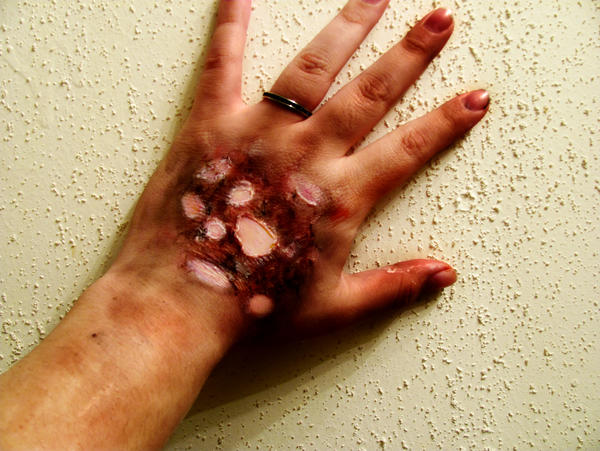 Burnt Hand Makeup.