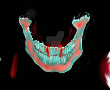 Jaw Bone X-Ray Study