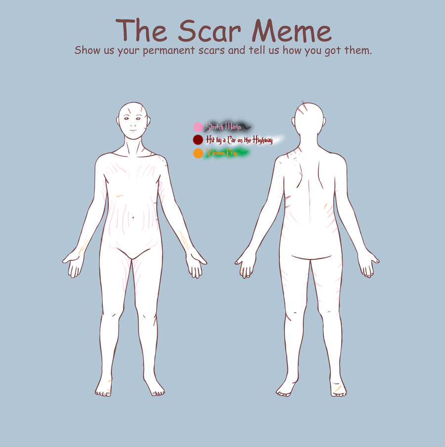 Scar Meme