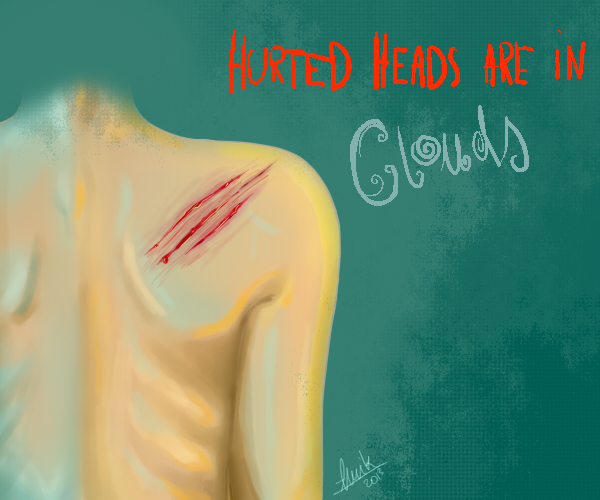 Hurted heads are in clouds.