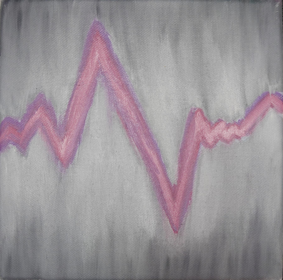 Pulse