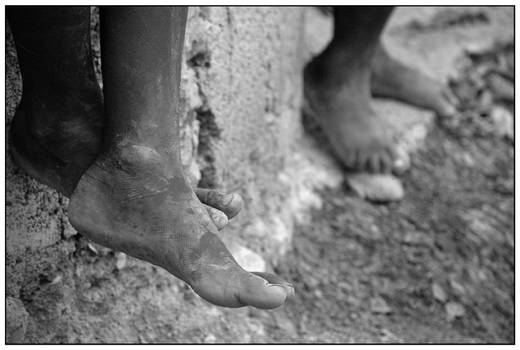 Haiti - Feet