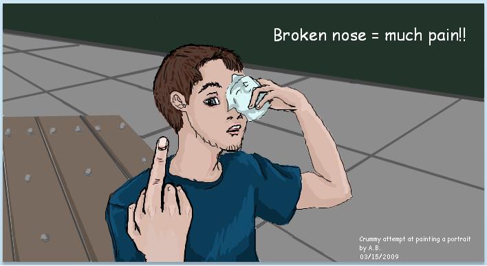 Broken Nose