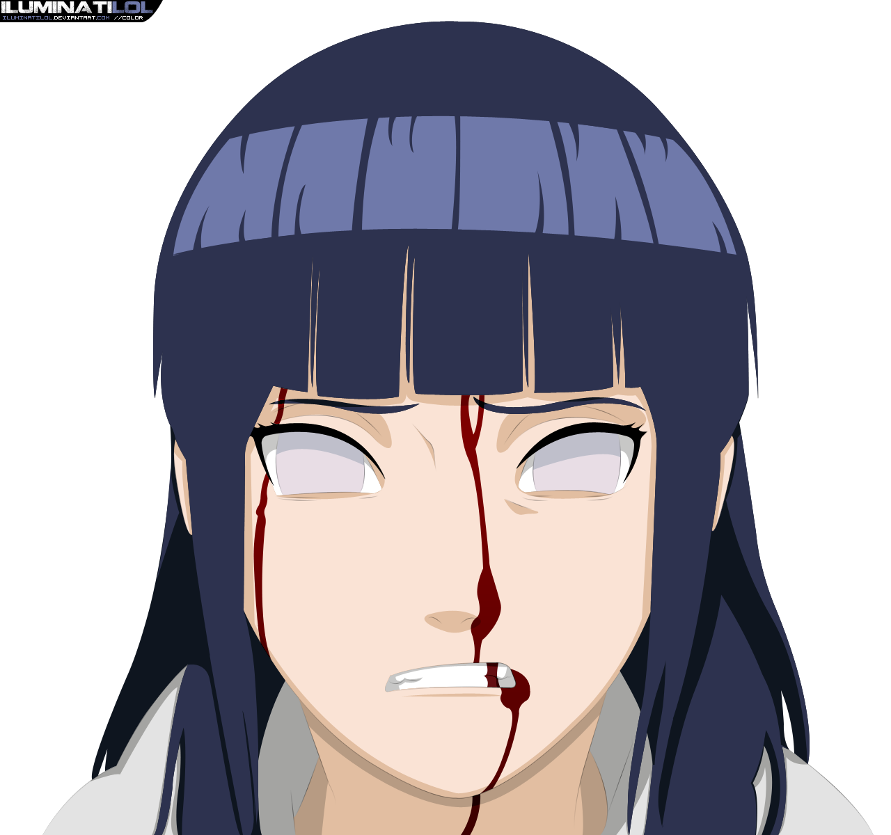 Hinata - Bleeding