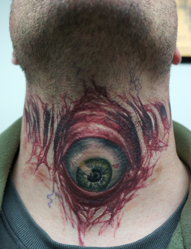 evil eyeball on throat...healed