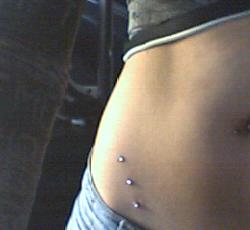 My dermal anchors