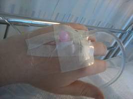 My Cannula 1