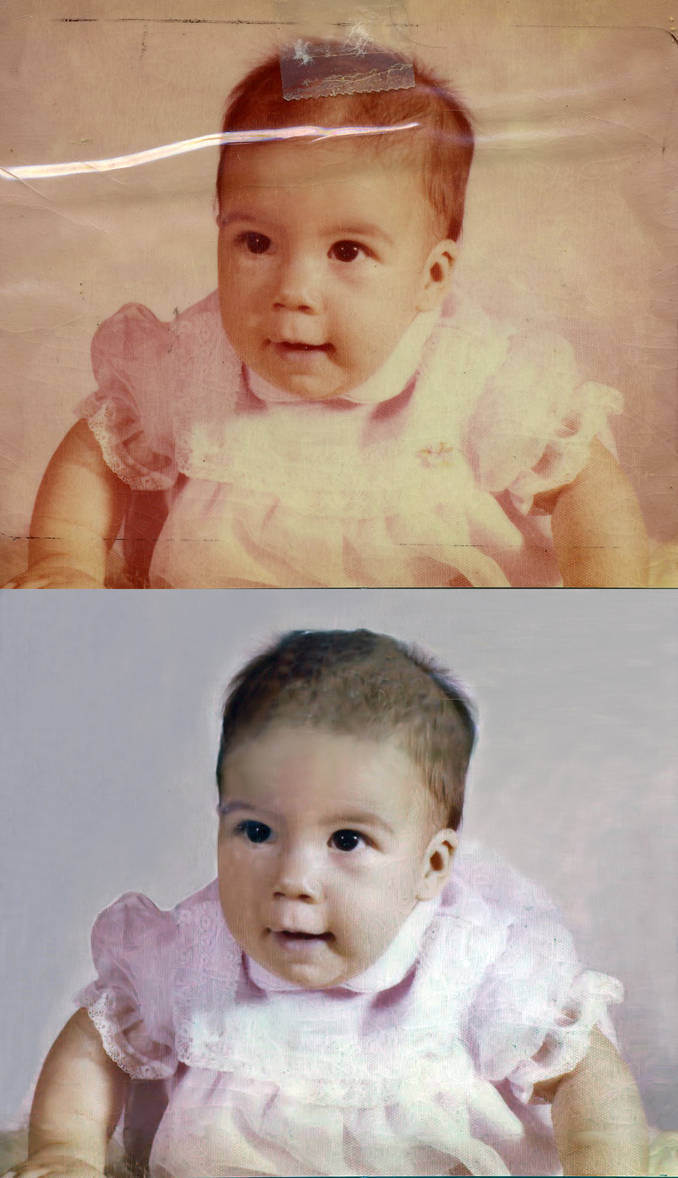 Infant Before and After