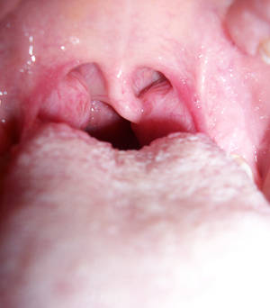 inside my mouth stock