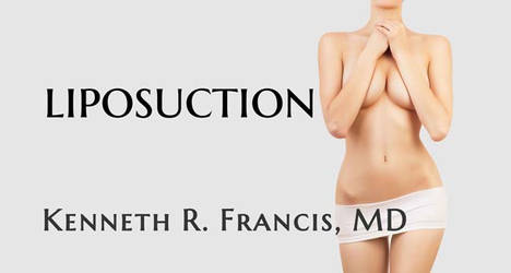 Liposuction NYC Plastic Surgeon