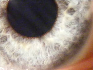 My Eye