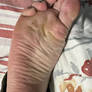 Scrunch!!