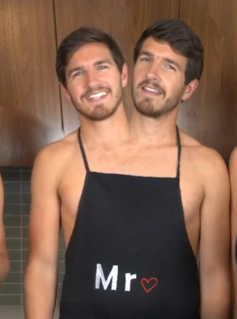 Conjoined twins couple by TheConjoiner on DeviantArt