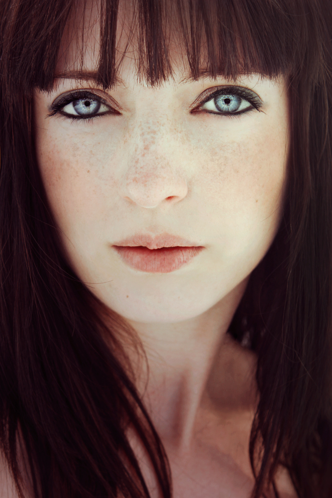 Freckles