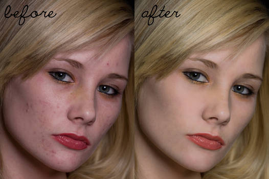 retouch- smooth skin