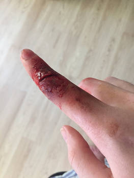 Sfx sliced finger