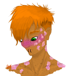 Freddy short hair with burns 