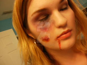 Bruise make up 2