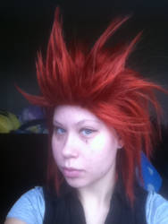 Axel Wig