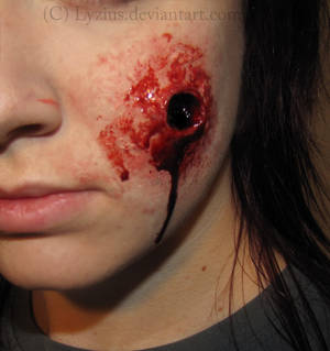 Bullet Wound Prosthetic