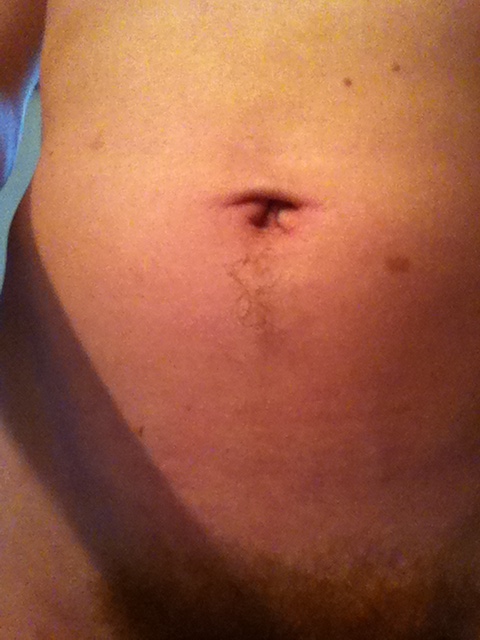 My Belly Button