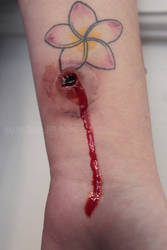 Entry Bullet Wound