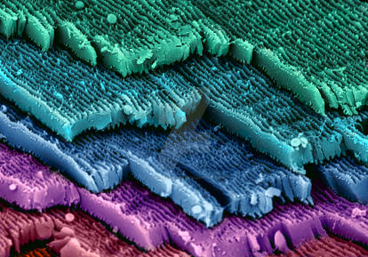 Eye lens cells captured with electron microscopy