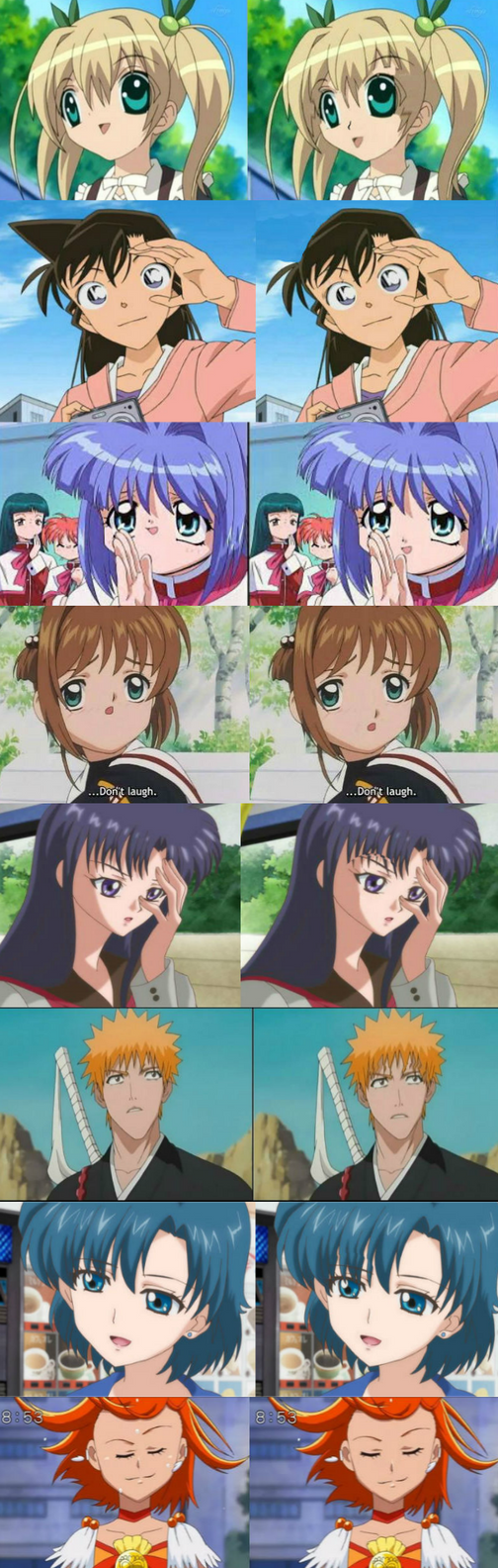 Anime plastic surgery by Purplecats000 on DeviantArt