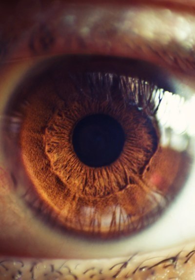 Eye