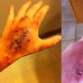 Burn Wound FX Makeup