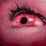 Pink Eye