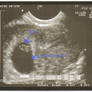 First Ultrasound