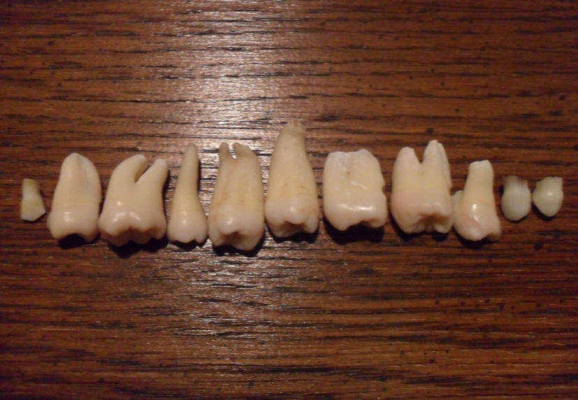 My human teeth collection by rustedmetalgate on DeviantArt