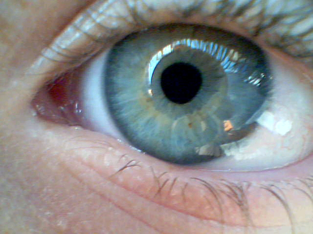 my eye