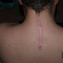 Broken neck Scar 2