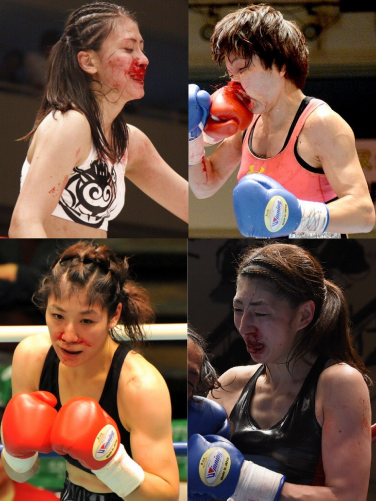 Tit boxing Tit boxing