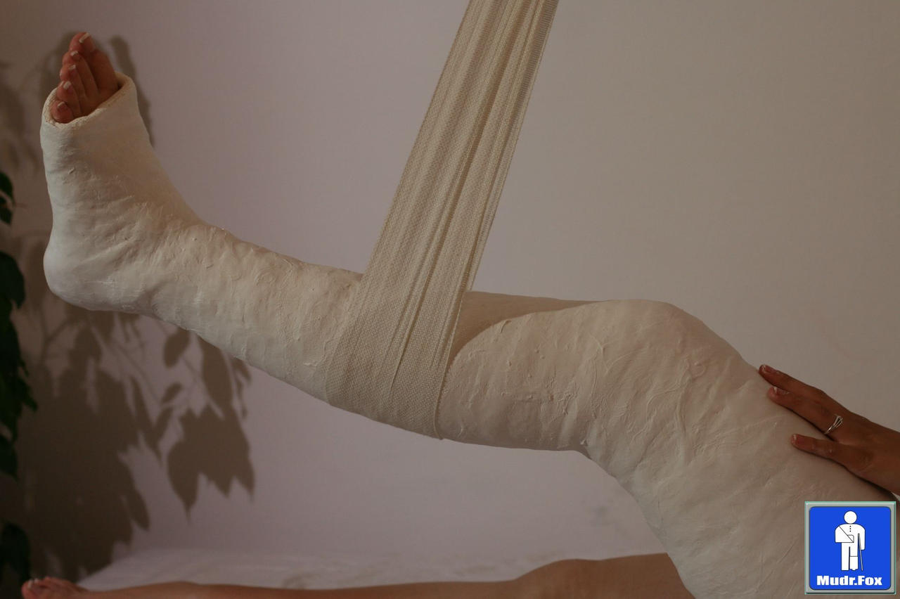 Long Leg Cast By Caster1210 On Deviantart Long Leg Cast By Caster1210 On Deviantart