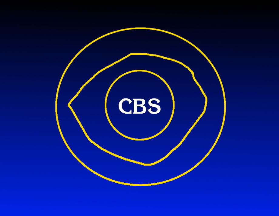 CBS ID (1981-1983) by MJEGameandComicFan89 on DeviantArt