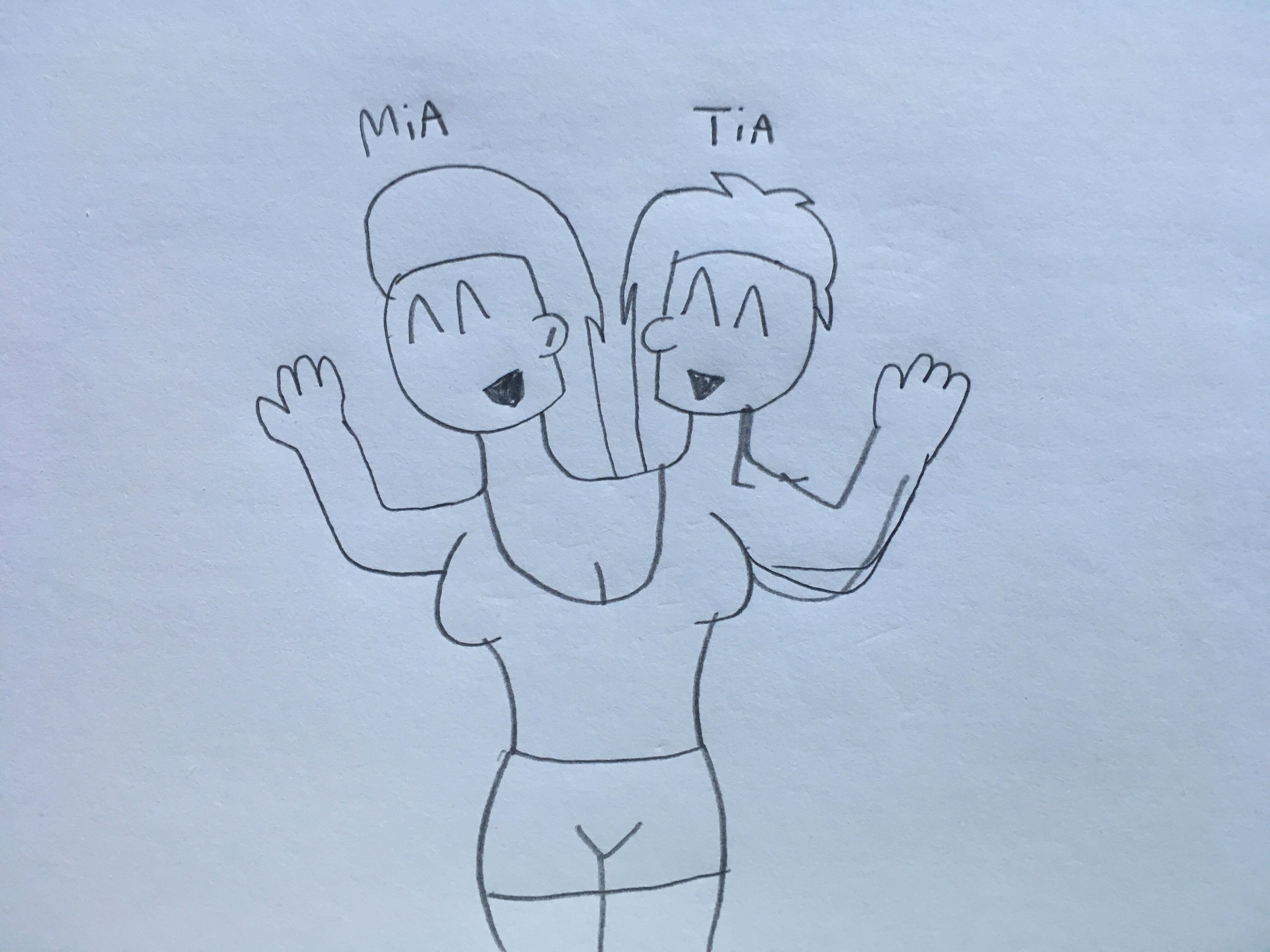 (OLD) Mia and Tia - The conjoined friends