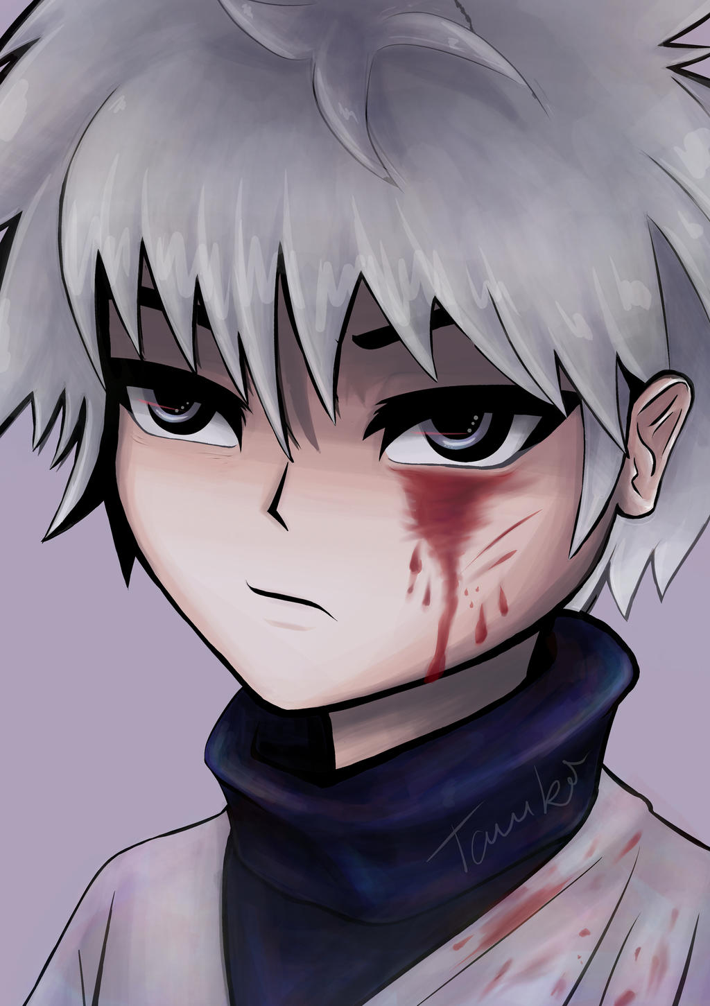 Killua - Hunter x Hunter