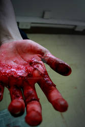 gore 2 of 8:hands burnt 2